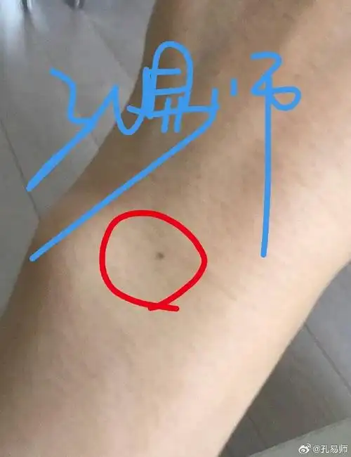 手腕痣～～命局里有贵人,关键时刻拉你一把!