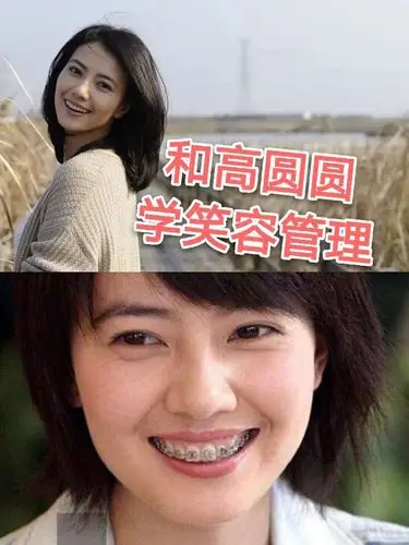 高圆圆牙齿有点小龅嘴唇并不算大甚至嘴角有些下垂有这些特征的宝宝