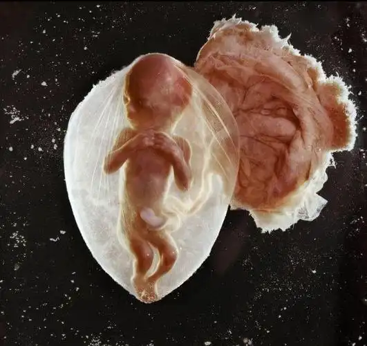 透彻!4个月的胎儿有多大"海外就医"-第1张图片-佩珍博客