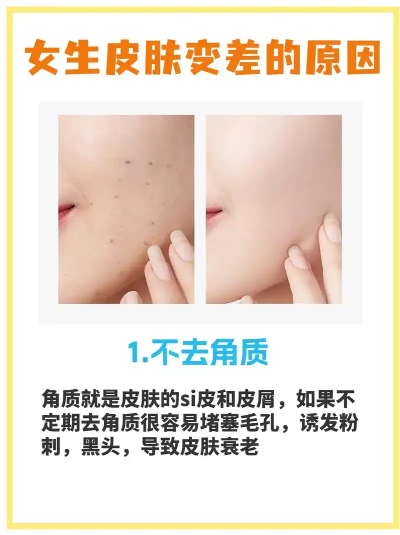 女生皮肤变差的原因,你中了几个71.