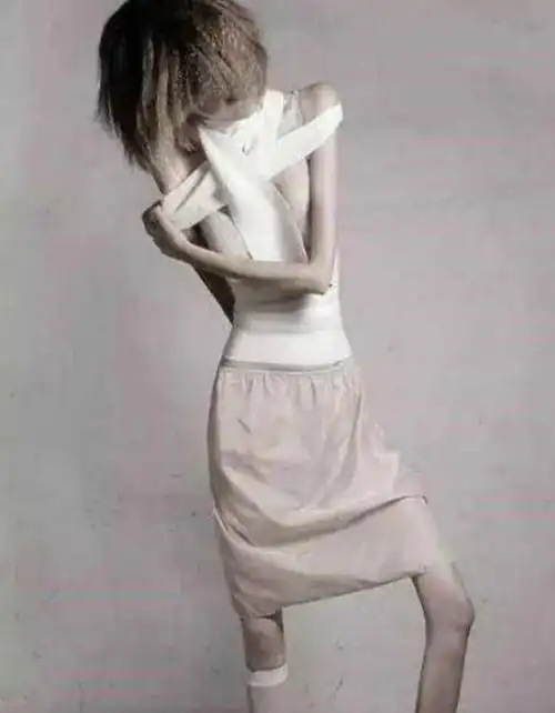 史上最瘦女孩仅44斤,看到真实照片后,网友的内心百感交集