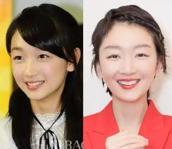 曾经被批牙黄的周冬雨凭借一口大白牙成为少年的你女主角