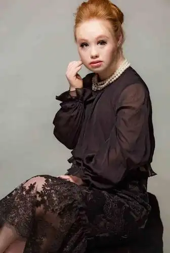 这个22岁的澳洲姑娘,带着改变世界的决心,用笑容和自信震撼整个时尚圈