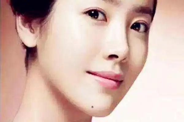 左下巴有痣好吗如今的社会女人也是半边天了,女人也拥有自己的事业