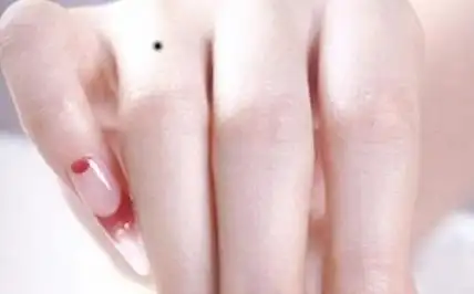 左手外侧有痣代表什么