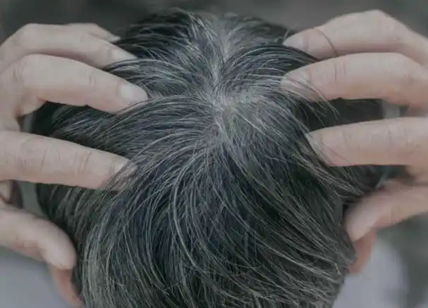 4,白发不知长十发,这句话纯属捏造. 真实情况是一根白发长一根!