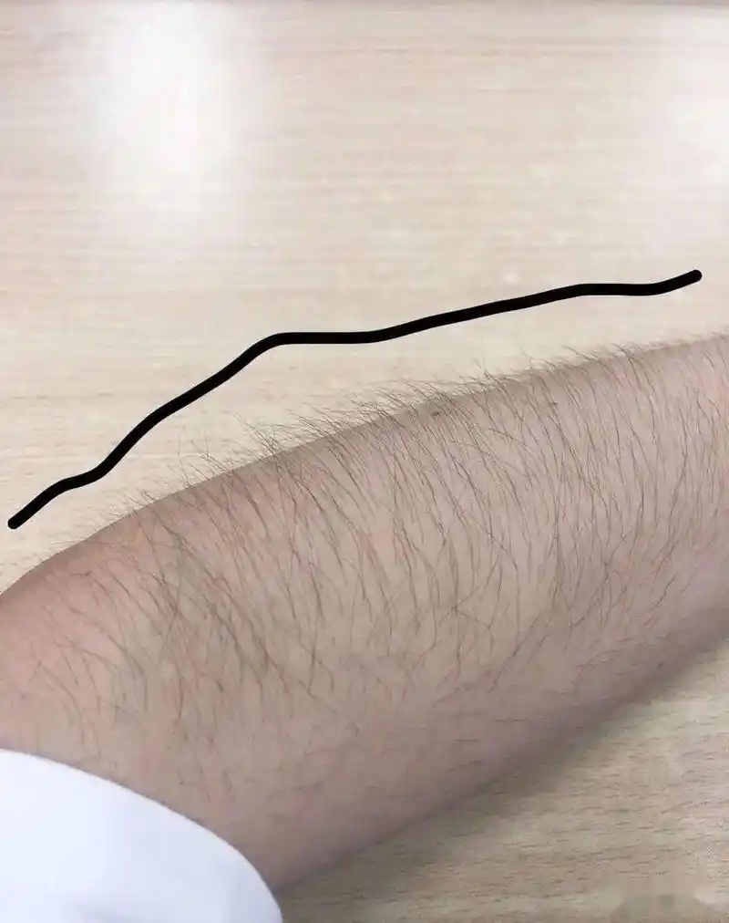 为什么有的女人体毛旺盛,有的却"寥寥无几"?哪种更好一些?