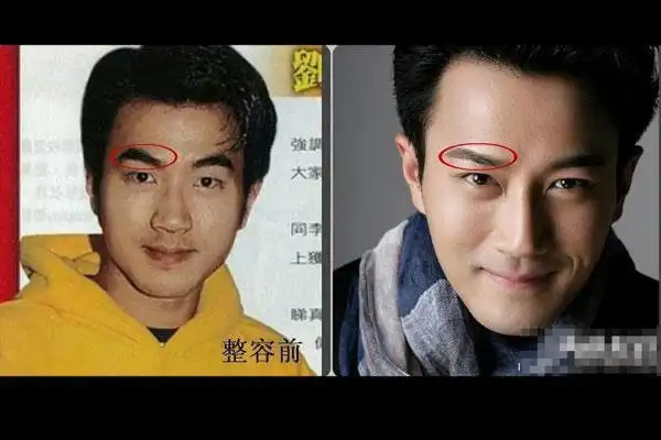刘恺威整容前照片曝光 变化巨大获称假面小生