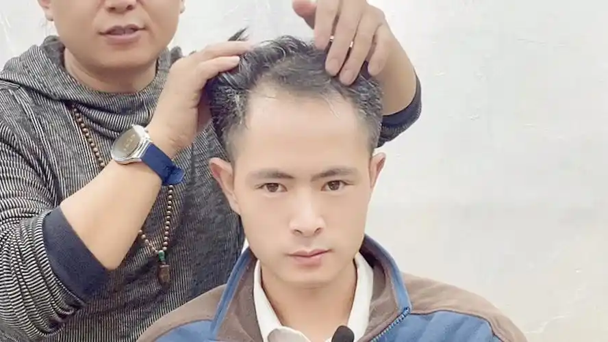 发际线高 头发稀少的男生适合什么发型