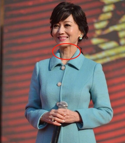 路人镜头下的赵雅芝仙气全无脖子上的皱纹明显