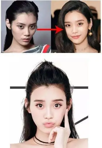 让自己看起来更旺夫往脸上填充了脂肪,所以前段时间露面的奚梦瑶苹果