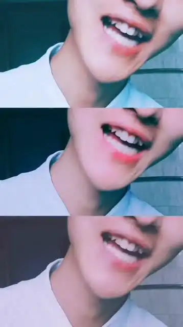 你们喜欢有虎牙的男生吗