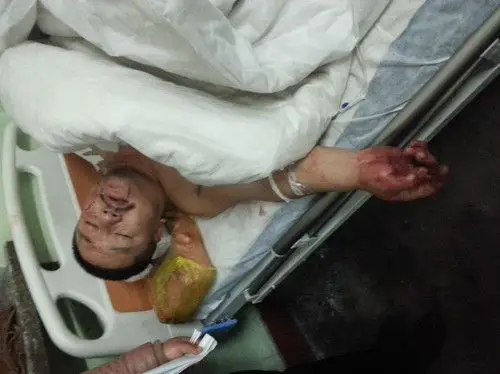 介休市宋古乡洪善村村长罗志文指示黑社会恶性砍村民事件致5人受伤