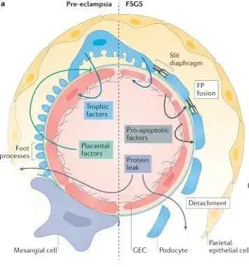 【肾世图卷】肾小球滤过屏障: 新的治疗靶点