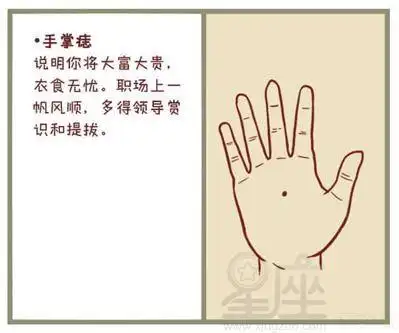 痣相图解:手心有痣好不好?
