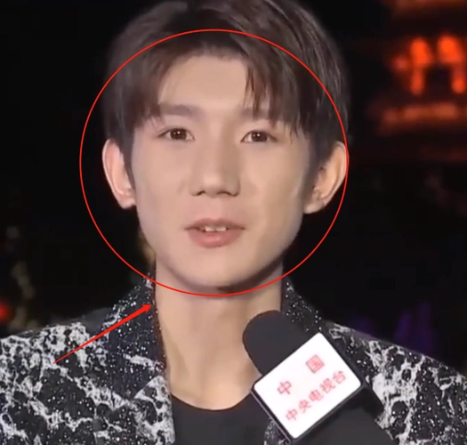 王源上央视节目无美颜直播暴露真实颜值这皮肤状态我没眼花