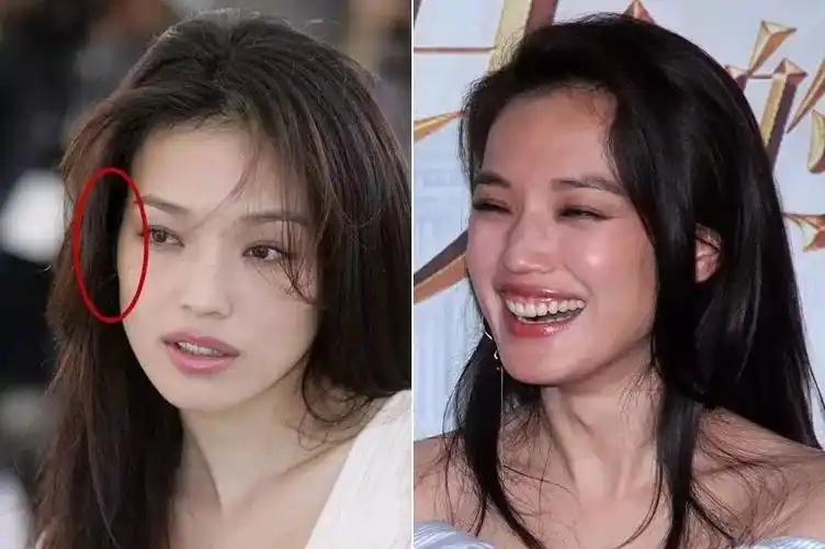 一般是倒三角形状的,笑起来会因为脸部肌肉的挤压而隆起