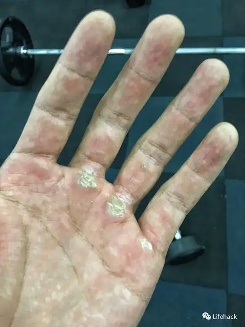 撸多了的男生,手都变成了这样