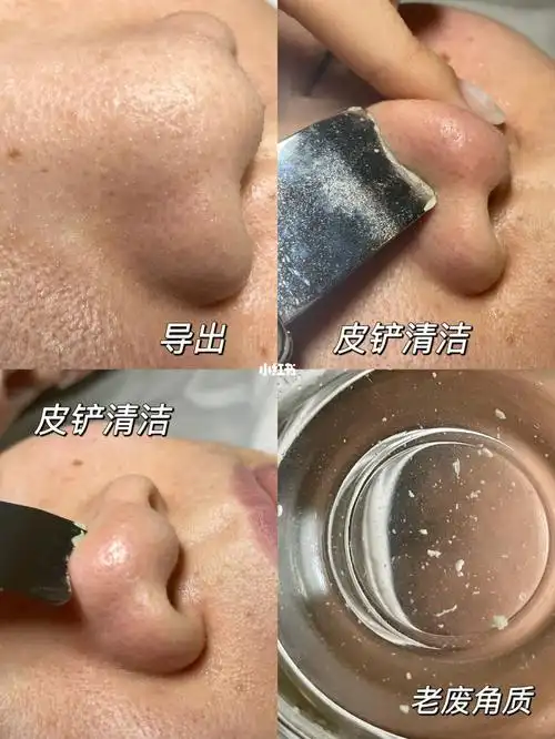 面部补水清洁03