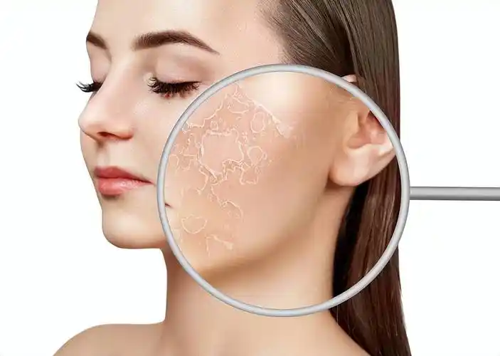 干性皮肤分为缺水性和缺油性?应该怎么护肤?