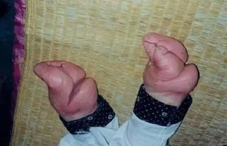 现在古装戏泛滥,但是都太假了.过去的女人都是三寸金莲,走路也好看.