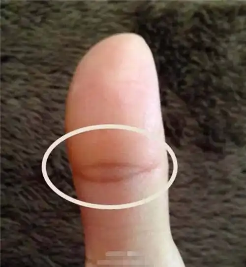 左手拇指上有「佛眼」的女人,不简单!你有吗?