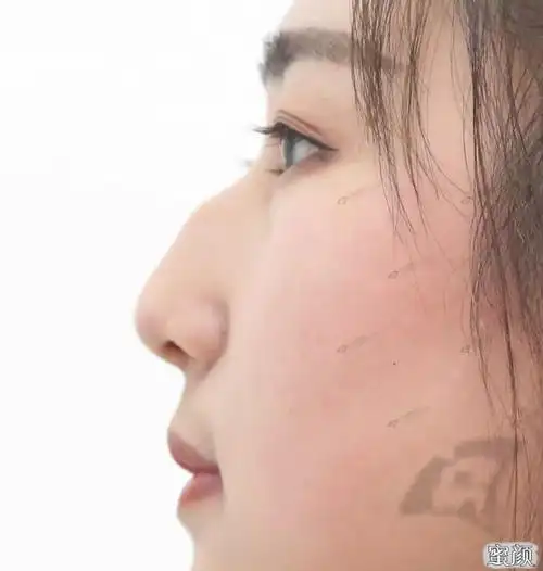 【美然】女孩驼峰鼻拯救 | 今年的520,我不在孤独!