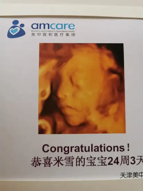 宝宝四维照片和出生对比