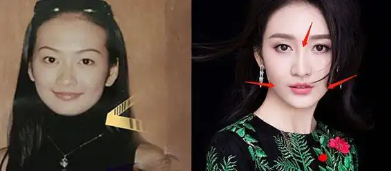 王鸥18岁高清旧照曝光!方脸塌鼻被评脸大如盆,再招网友质疑整容