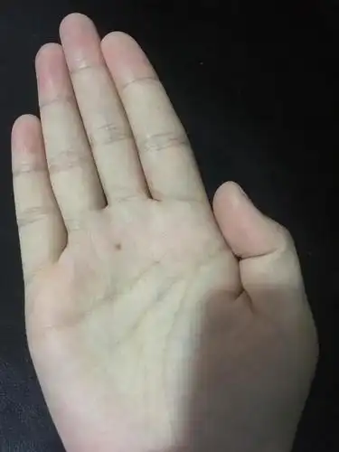 你掌心的痣我总记得在哪里