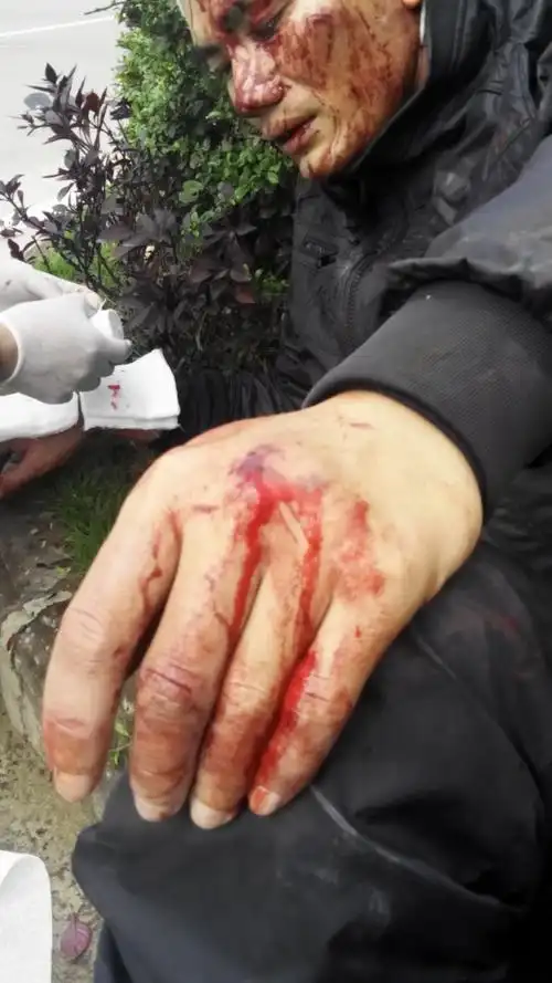 被人当街追打成了犯罪嫌疑人