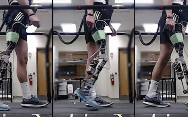 美国研究者将借助人工智能来帮助残障人士调整假肢