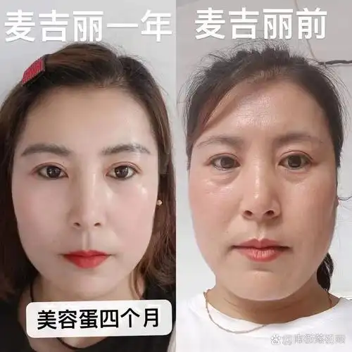 这里是我用了麦吉丽护肤品前后的对比