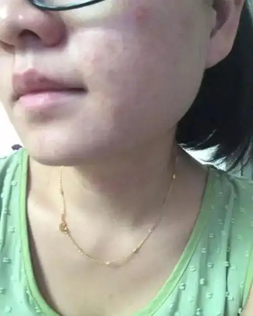 护肤品过敏的症状(化妆品过敏症状看这些) - 天华易学