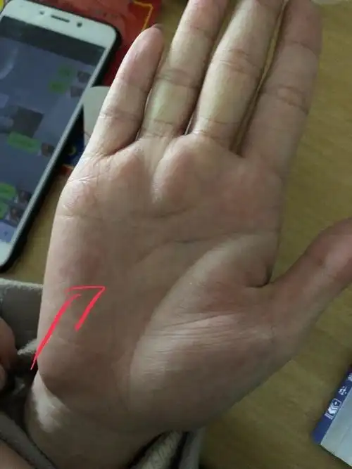 手相月丘上的斜线是什么意思