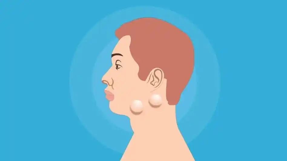 淋巴结是什么东西(淋巴结是什么东西引起的)