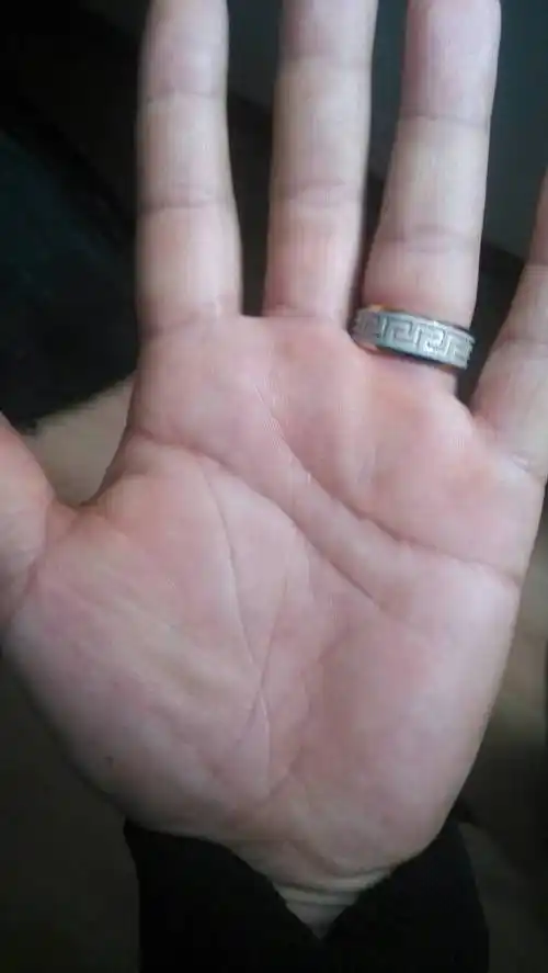 我双手生命线都较短,是不是会自杀?几乎都看不见