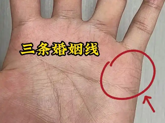 罕见的三条婚姻线