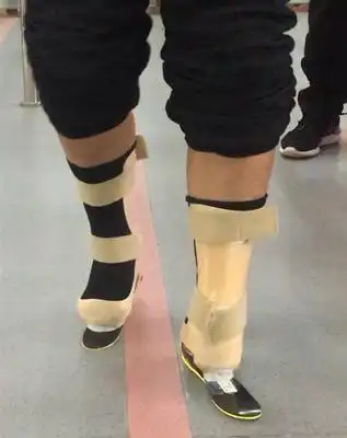 昆明长亭假肢矫形康复器材有限公司