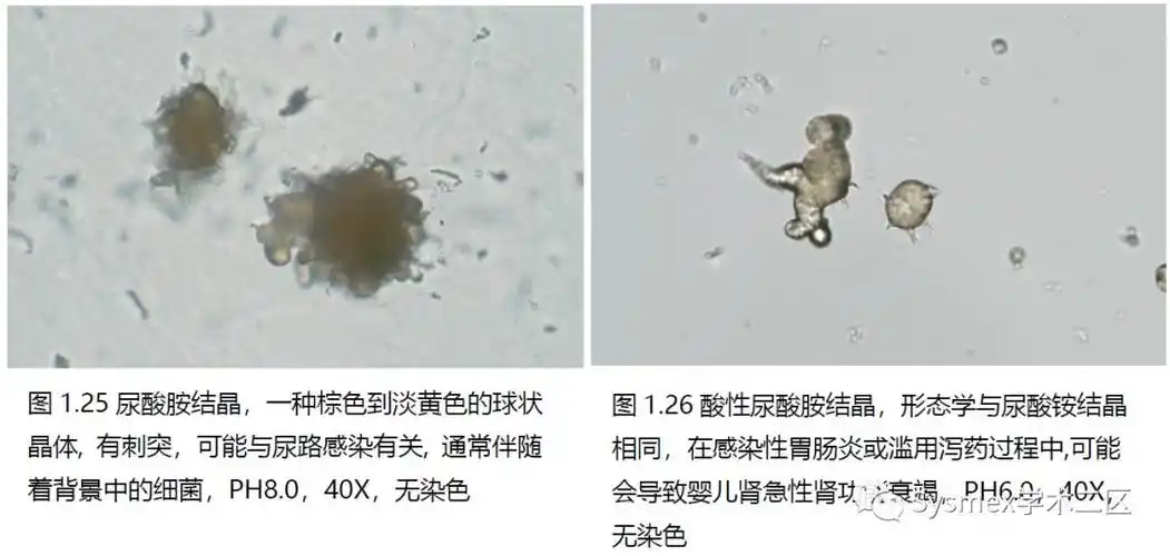 尿液结晶形态汇总