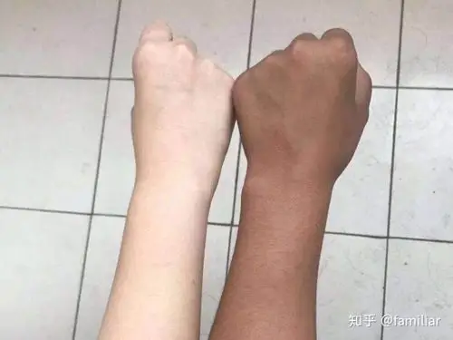 有没有晒黑后美白的方法啊