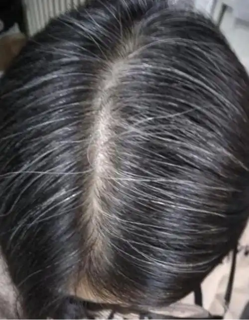 白头发看起来显老但真的是因为衰老吗其实另有原因