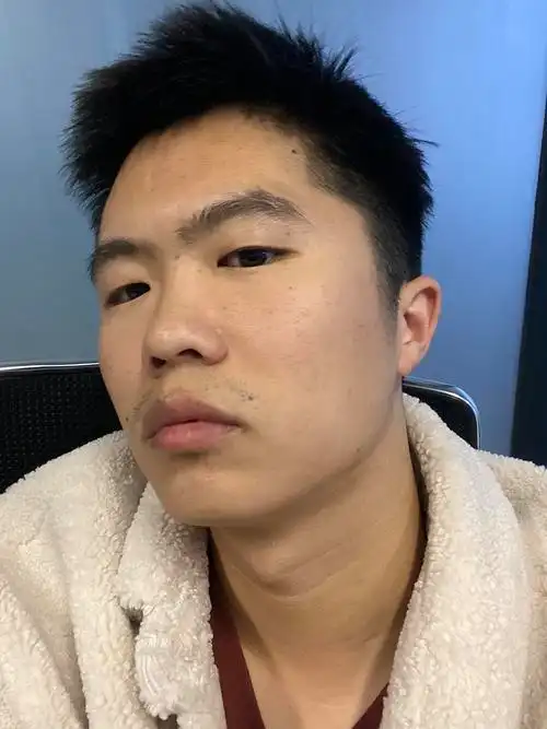 朋友都说我自拍巨丑真的吗?