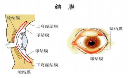 覆盖于眼睑后和眼球前的一层半透明黏膜组织,由睑结膜,穹隆部结膜和球