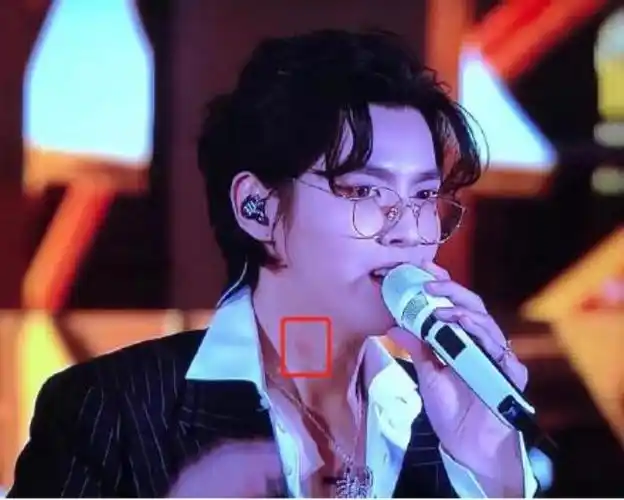 而且传得挺开的,他始终没有回应过,这次脖子上出现疑似吻痕的红点