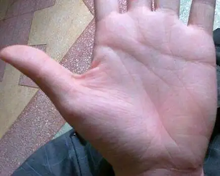 什么样的手相是会早死的手相