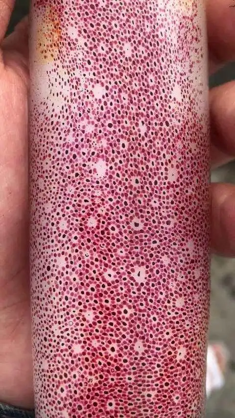 密集恐惧症慎点不仔细看还以为小伙长鳞片了看完这35张图你的密集恐惧