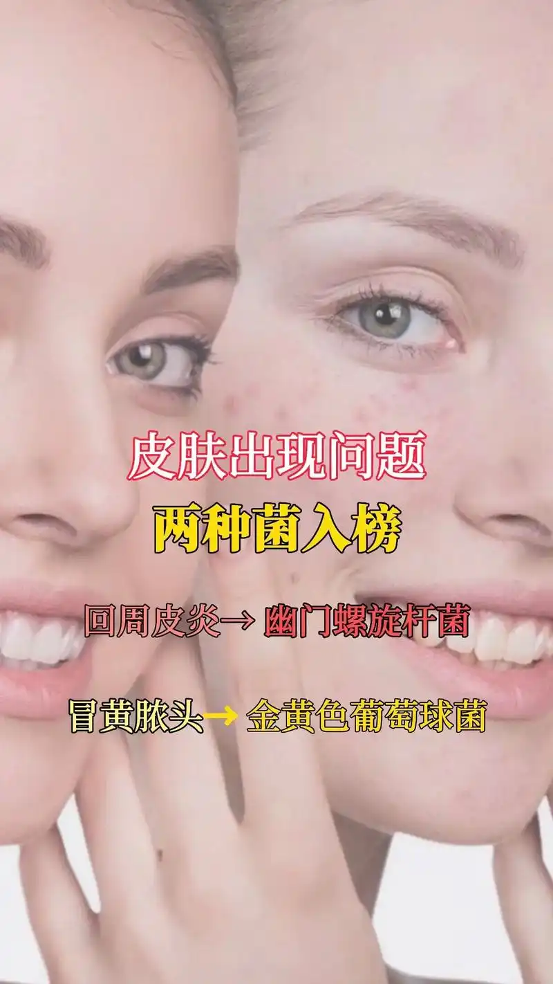 皮肤出现问题 两种菌入榜.了解皮肤困扰,问题都好办#护肤#换 - 抖音