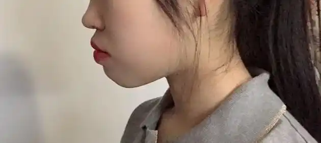 凸嘴女孩球球你们千万别学jennie和泫雅的红唇妆,直接凸成原始人