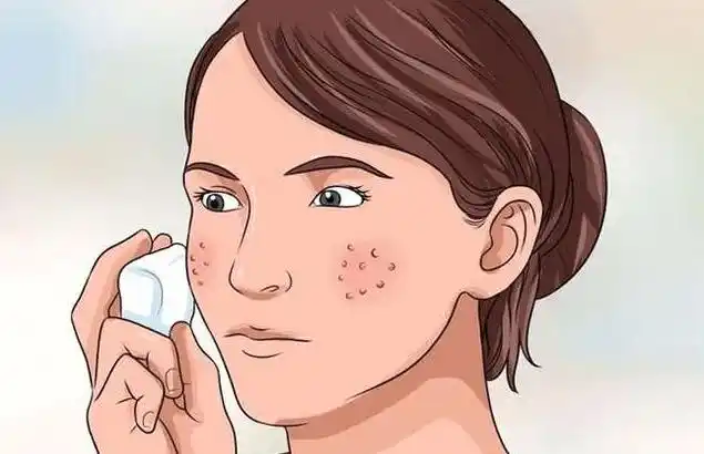 脸上的毛孔粗大怎么办怎么来解决